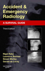 Accident and Emergency Radiology: A Survival Guide
