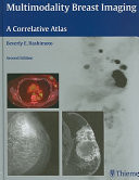 Multimodality Breast Imaging