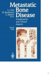 Metastatic Bone Disease