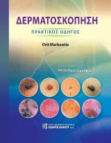 Δερματοσκόπηση: Πρακτικός οδηγός