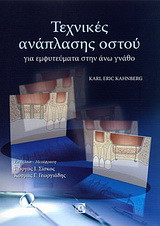 Τεχνικές ανάπλασης ιστού: Για εμφυτεύματα στην άνω γνάθο