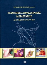 Τραχηλικές λεμφαδενικές μεταστάσεις: Διάγνωση και θεραπεία