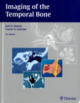 Imaging of the Temporal Bone