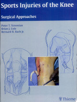 Sports Injuries of the Knee