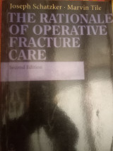 The rationale of operative fracture care